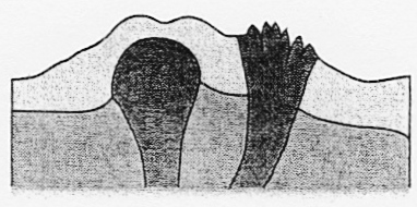 Quell staukuppe